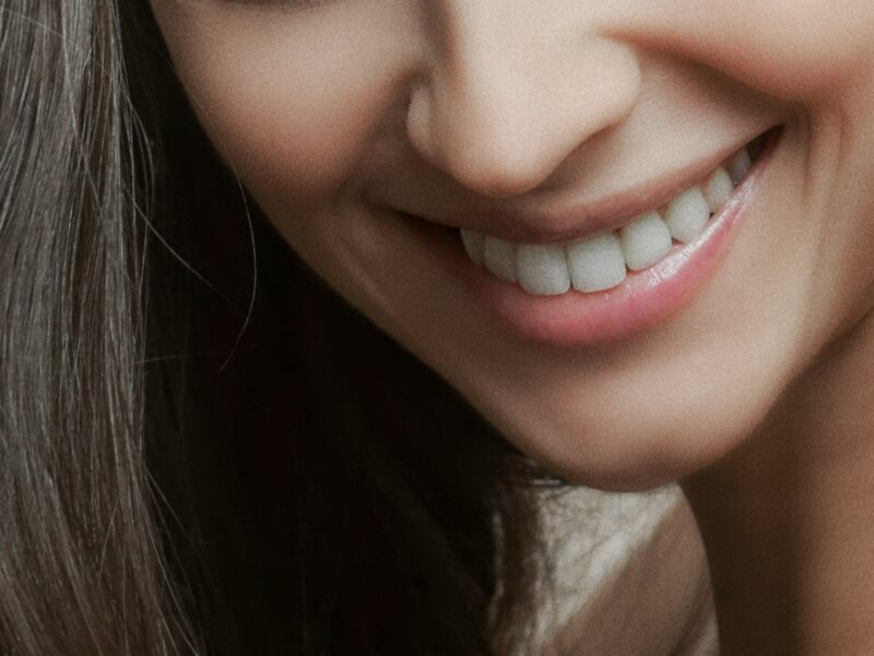 Buzëqeshje pas trajtimit me Invisalign