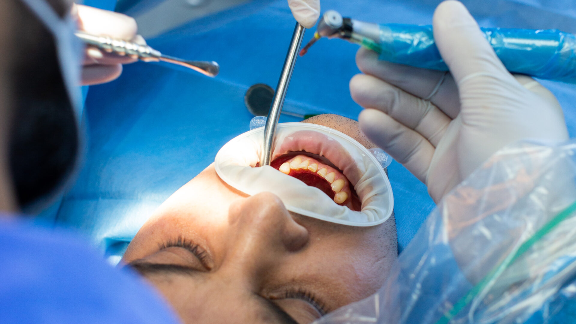 dentist and assistant with tool makes some manipulations in the patient's mouth