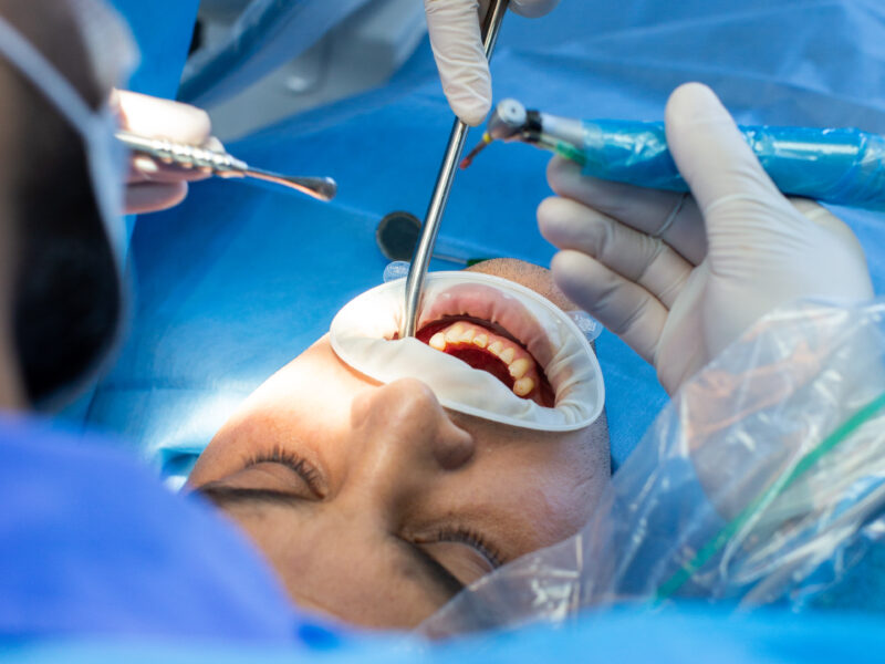 dentist and assistant with tool makes some manipulations in the patient's mouth